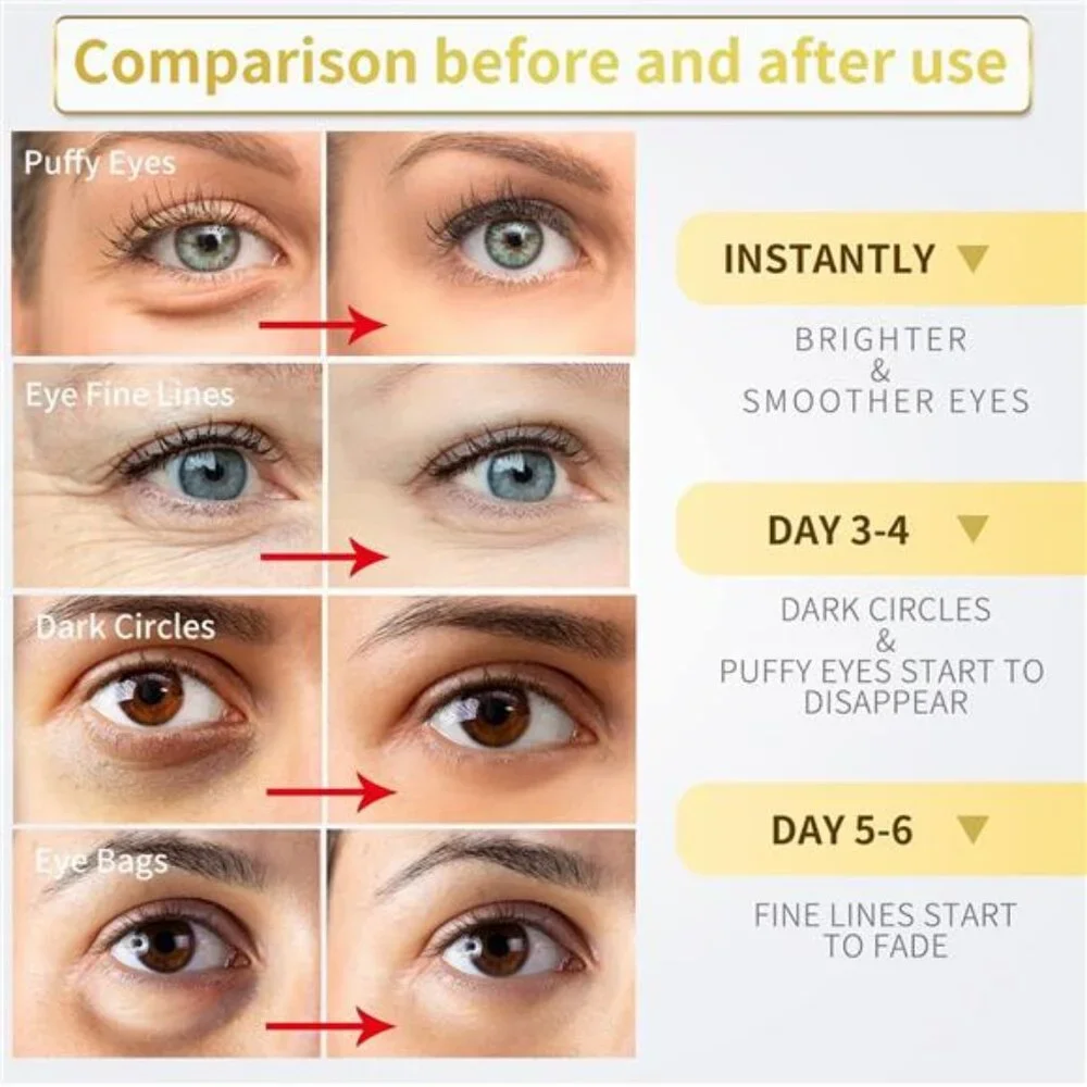 Under Eye Patches - 60 Pcs - 24K Gold Eye Mask- Puffy‎ Eyes & Dark Circles
